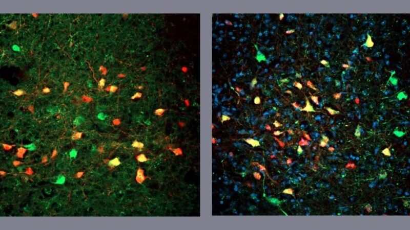 Pesquisadores descobrem neurônios que levam à alimentação compulsiva mesmo sem fome