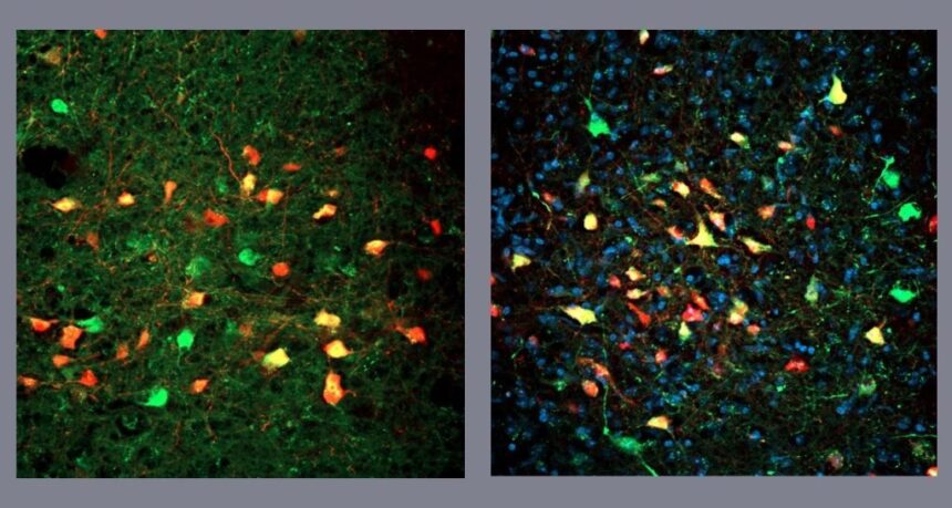 Pesquisadores descobrem neurônios que levam à alimentação compulsiva mesmo sem fome