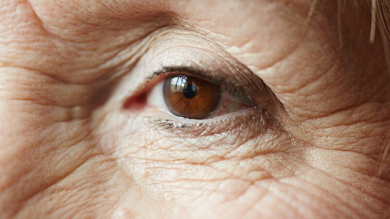 USP: mapeamento da retina pode indicar risco de Alzheimer com antecedência